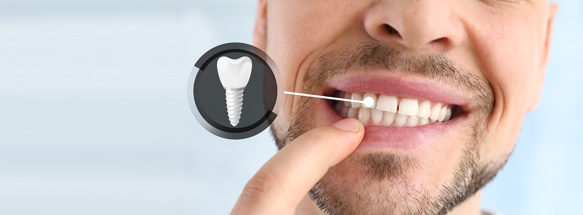 The image shows a person with a toothbrush in their mouth, focusing on cleaning their teeth, with a magnified view of a dental implant insertion tool.