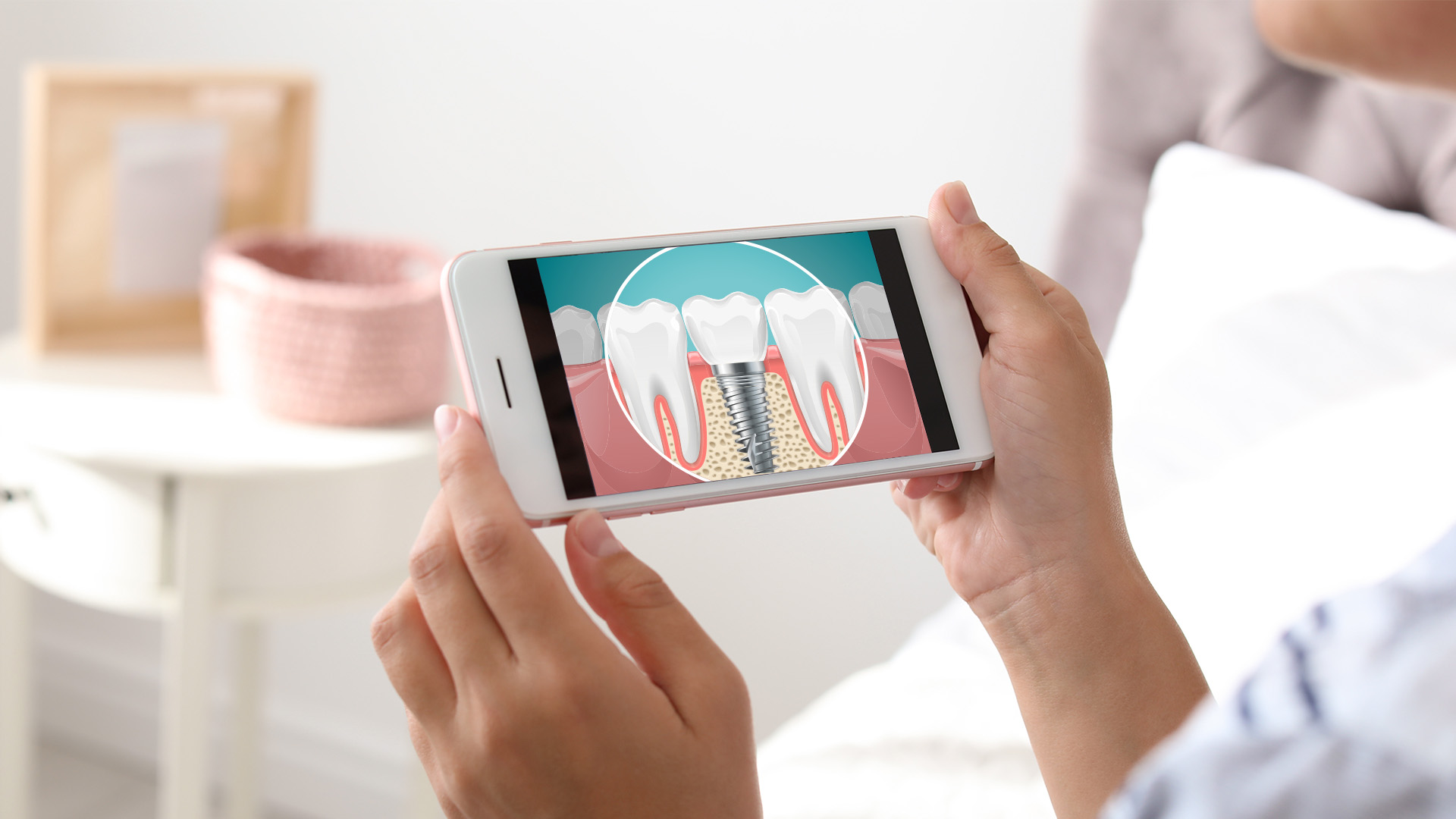 Person holding a smartphone displaying an image of a tooth with a cavity, likely for educational or informative purposes.