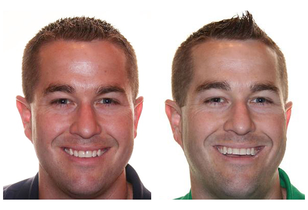 Radiant Dental Studio Forest Hills