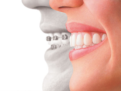 Image  A split-screen photograph showing a person s smiling face on the left and an enlarged image of their teeth on the right, emphasizing dental hygiene.