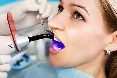 A woman receiving dental care, with a dental professional using an ultrasonic cleaning device and purple dye to clean her teeth.