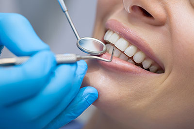 An image of a dental professional performing oral care on a patient, with the focus on the dental tools and the patient s mouth.