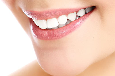 Woman s smiling face with teeth whitening product advertisement.