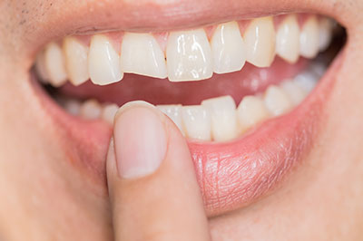 The image shows a person s hand holding up a finger with a fake tooth attached to it, positioned in front of a smiling mouth.