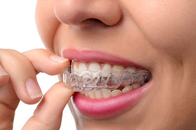 A person with a toothy smile holding a dental impression tray to their mouth.