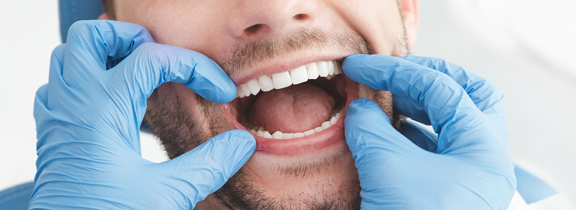 The image shows a person, presumably male, with a beard and mustache, wearing blue gloves and smiling widely at the camera. He appears to be in a dental or medical setting due to the presence of a white coat and a stethoscope around his neck.